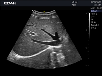 EDAN Acclarix LX25