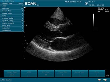 EDAN U50
