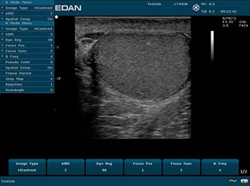 EDAN U50