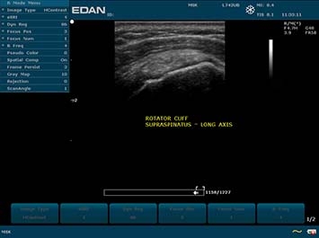 EDAN U50