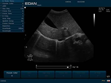 EDAN U2 VET