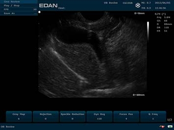 EDAN U50 VET