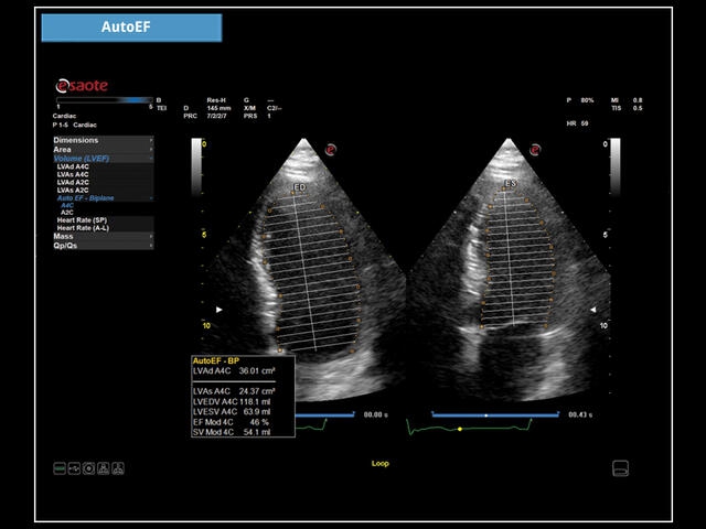 Esaote MyLab X7
